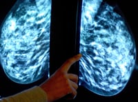 Tens of thousands of Devon women miss “vital” breast cancer screenings